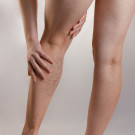 Nom: Cames cansades i varices