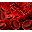 Anemia