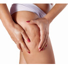 Nom: Celulitis