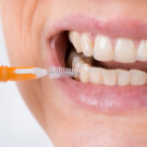 Interdentals