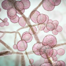 Candidiasis