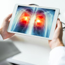 Infecciones respiratorias